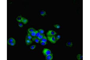 Immunofluorescent analysis of MCF-7 cells using ABIN7158090 at dilution of 1:100 and Alexa Fluor 488-congugated AffiniPure Goat Anti-Rabbit IgG(H+L)
