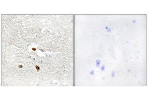 Immunohistochemistry (IHC) image for anti-Zinc Finger Protein 287 (ZNF287) (Internal Region) antibody (ABIN1849990) (ZNF287 anticorps  (Internal Region))