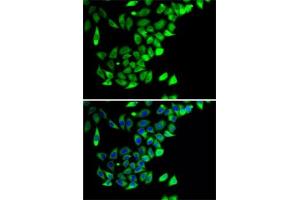 Immunofluorescence analysis of A-549 cells using PTGES2 antibody (ABIN6129085, ABIN6146404, ABIN6146406 and ABIN6222952). (PTGES2 anticorps  (AA 88-377))
