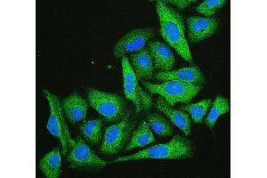 IF analysis of Cofilin-2 using anti-Cofilin-2 antibody (ABIN7602747).