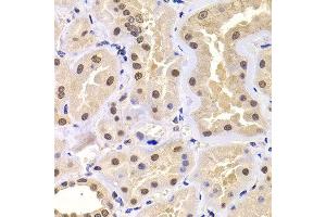 Immunohistochemistry of paraffin-embedded human kidney using PRDM14 antibody at dilution of 1:100 (x400 lens). (PRDM14 anticorps)