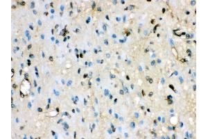 Anti- VCP Picoband antibody, IHC(P) IHC(P): Human Glioma Tissue