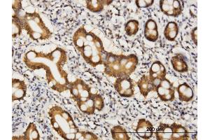Immunoperoxidase of monoclonal antibody to COASY on formalin-fixed paraffin-embedded human small Intestine.