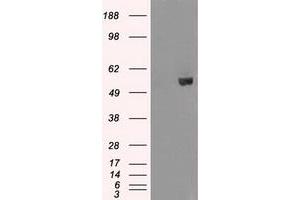 Image no. 2 for anti-V-Akt Murine Thymoma Viral Oncogene Homolog 2 (AKT2) antibody (ABIN1496565)