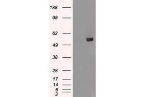 Image no. 2 for anti-V-Akt Murine Thymoma Viral Oncogene Homolog 2 (AKT2) antibody (ABIN1496565) (AKT2 anticorps)