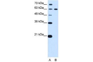 DTX2 antibody used at 0. (DTX2 anticorps)