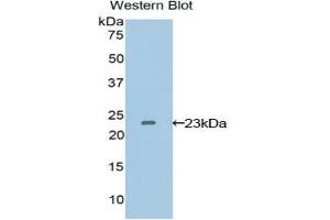 Western blot analysis of the recombinant protein. (VEGFB anticorps  (AA 22-207))