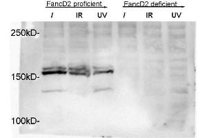 Image no. 2 for anti-Fanconi Anemia, Complementation Group D2 (FANCD2) (N-Term) antibody (ABIN363390)