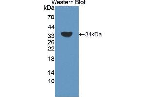 Western blot analysis of the recombinant protein. (ADRBK2 anticorps  (AA 191-453))