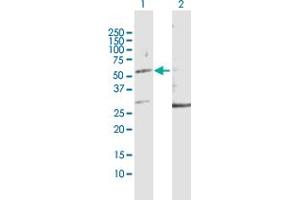 Western Blot analysis of KRT32 expression in transfected 293T cell line by KRT32 MaxPab polyclonal antibody. (KRT32 anticorps  (AA 1-448))