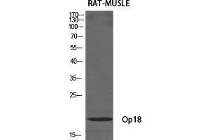 Western Blot (WB) analysis of specific cells using Op18 Polyclonal Antibody.