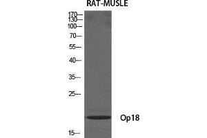 Western Blot (WB) analysis of specific cells using Op18 Polyclonal Antibody. (Stathmin 1 anticorps  (Ser729))