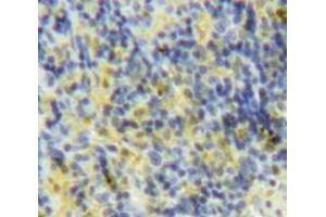Used in DAB staining on fromalin fixed paraffin-embedded Spleen tissue (XCL1 anticorps  (AA 26-111))