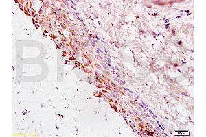 Formalin-fixed and paraffin embedded rat ovary tissue labeled with Anti-Cyclin G Polyclonal Antibody, Unconjugated (ABIN685837) at 1:200 followed by conjugation to the secondary antibody and DAB staining (Cyclin G1 anticorps  (AA 181-295))