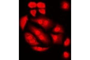 Immunofluorescent analysis of Int11 staining in Hela cells.