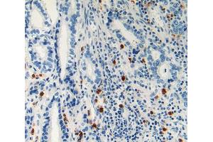 Used in DAB staining on fromalin fixed paraffin- embedded stomach cancer tissue (LAMC2 anticorps  (AA 416-602))