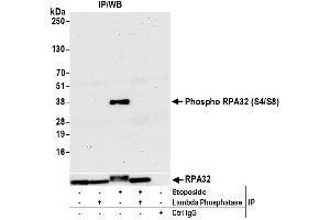 Immunoprecipitation (IP) image for anti-Replication Protein A2, 32kDa (RPA2) (pSer4), (pSer8) antibody (ABIN7455212) (RPA2 anticorps  (pSer4, pSer8))