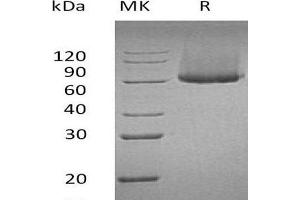 Western Blotting (WB) image for Glypican 1 (GPC1) (Active) protein (His tag) (ABIN7320535)