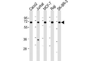 All lanes : Anti-P27 Antibody (Center) at 1:2000 dilution Lane 1: Caco2 whole cell lysates Lane 2: Jurkat whole cell lysates Lane 3: MCF-7 whole cell lysates Lane 4: Raji whole cell lysates Lane 5: SK-BR-3 whole cell lysates Lysates/proteins at 20 μg per lane. (MMP27 anticorps  (AA 333-367))