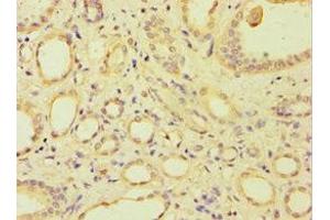 Immunohistochemistry of paraffin-embedded human kidney tissue using ABIN7144692 at dilution of 1:100 (ARSF anticorps  (AA 1-200))