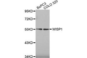 Western blot analysis of extracts of various cell lines, using WISP1 antibody.