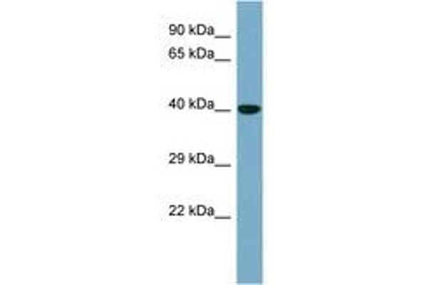 KCTD16 anticorps  (AA 107-156)