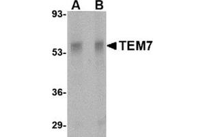 Western blot analysis of TEM7 in rat liver tissue lysate with this product at (A) 0. (PLXDC1 anticorps  (Center))
