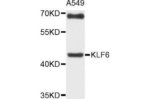 Western blot analysis of extracts of A549 cells, using KLF6 antibody. (KLF6 anticorps)