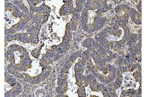IHC analysis of ATP5F1B using anti-ATP5F1B antibody (ABIN7599866). (Atp5f1b (AA 123-529) anticorps)