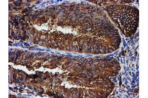 Image no. 5 for anti-Protein Disulfide Isomerase Family A, Member 4 (PDIA4) antibody (ABIN1500110)