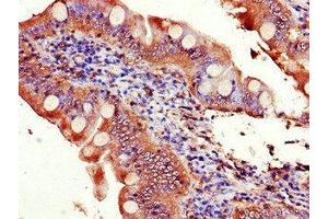 Immunohistochemistry of paraffin-embedded human small intestine tissue using ABIN7152149 at dilution of 1:100 (EIF3C anticorps  (AA 201-500))