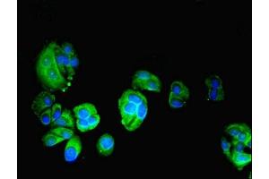 Immunofluorescent analysis of MCF-7 cells using ABIN7163072 at dilution of 1:100 and Alexa Fluor 488-congugated AffiniPure Goat Anti-Rabbit IgG(H+L)