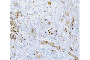 IHC analysis of SQSTM1 using anti-SQSTM1 antibody (ABIN3043937). (SQSTM1 anticorps  (N-Term))