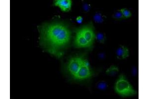 Image no. 6 for anti-Hexokinase 2 (HK2) antibody (ABIN1498647) (Hexokinase 2 anticorps)