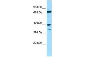WB Suggested Anti-EIF2B2 Antibody Titration: 1.