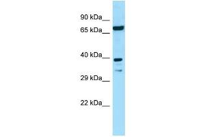 WB Suggested Anti-EIF2B2 Antibody Titration: 1. (EIF2B2 anticorps  (N-Term))
