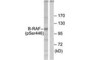 Western blot analysis of extracts from 293 cells treated with EGF 200ng/ml 30', using B-RAF (Phospho-Ser446) Antibody.
