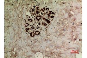 Immunohistochemistry (IHC) analysis of paraffin-embedded Human Breast, antibody was diluted at 1:100.