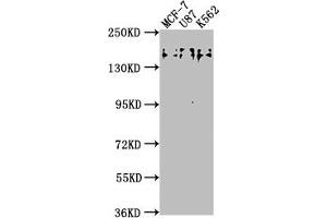 Western Blot Positive WB detected in: MCF-7 whole cell lysate, U87 whole cell lysate, K562 whole cell lysate All lanes: TJP2 antibody at 1:2000 Secondary Goat polyclonal to rabbit IgG at 1/50000 dilution Predicted band size: 134, 118, 112, 132, 116, 131, 138 kDa Observed band size: 150 kDa (TJP2 anticorps  (AA 1165-1183))