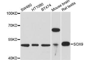 Western blot analysis of extracts of various cell lines, using SOX9 antibody. (SOX9 anticorps)
