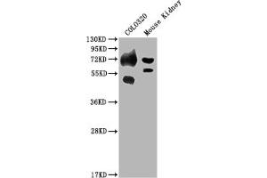 Western Blot Positive WB detected in: COLO320 whole cell lysate, Mouse Kidney tissue All lanes: SLC39A4 antibody at 1:2000 Secondary Goat polyclonal to rabbit IgG at 1/50000 dilution Predicted band size: 69, 67 kDa Observed band size: 69 kDa