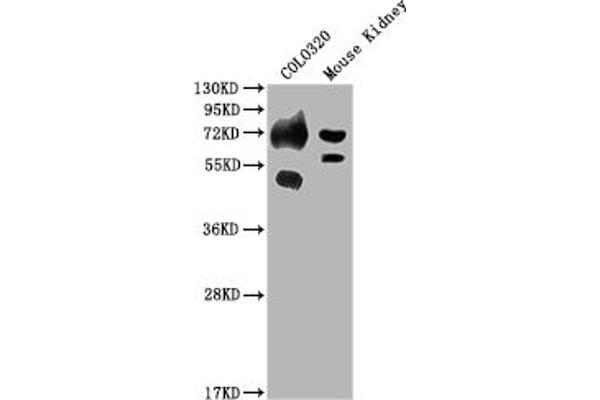 SLC39A4 Antikörper  (AA 26-266)