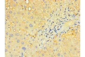 Immunohistochemistry of paraffin-embedded human liver tissue using ABIN7170195 at dilution of 1:100