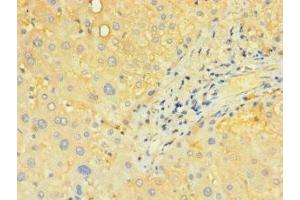 Immunohistochemistry of paraffin-embedded human liver tissue using ABIN7170195 at dilution of 1:100 (SLC25A4 anticorps  (AA 40-102))