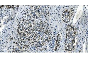 IHC analysis of TMBIM1 using anti-TMBIM1 antibody (ABIN7603190). (TMBIM1 anticorps  (N-Term))