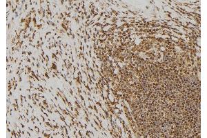 ABIN6269149 at 1/100 staining Human gastric tissue by IHC-P.
