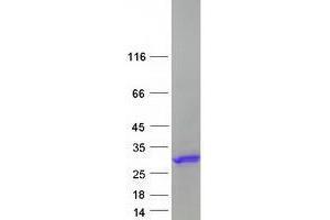 Validation with Western Blot