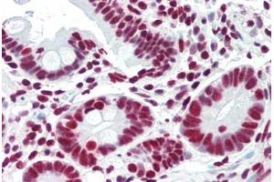 Human Small Intestine (formalin-fixed, paraffin-embedded) stained with ACIN1 antibody ABIN461879 at 5 ug/ml followed by biotinylated goat anti-rabbit IgG secondary antibody ABIN481713, alkaline phosphatase-streptavidin and chromogen. (ACIN1 anticorps)