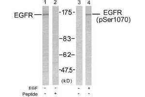 Image no. 2 for anti-Epidermal Growth Factor Receptor (EGFR) (pSer1070) antibody (ABIN196758) (EGFR anticorps  (pSer1070))