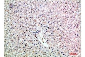Immunohistochemical analysis of paraffin-embedded human-liver, antibody was diluted at 1:200